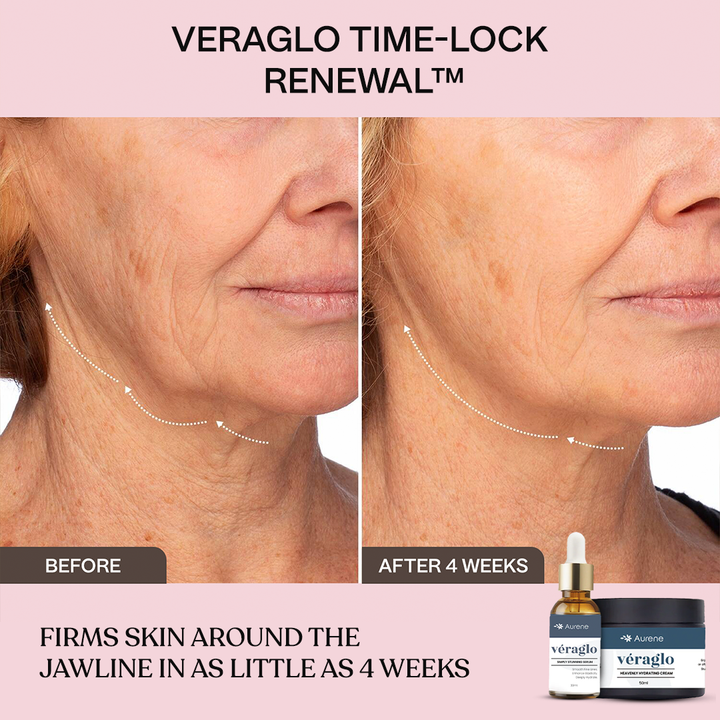 véraglo® Time-Lock Renewal™ Retinol Infusion System